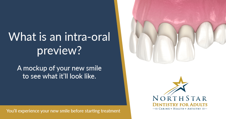 What is an intra-oral preview? 