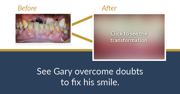 Fixing Bad Teeth: Gary’s New Outlook on Life